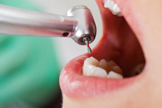 Best Pediatric Emergency Dentist in Dravosburg, PA